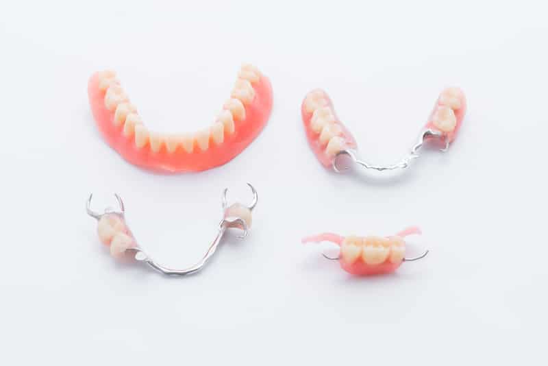 Set of dentures and partial dentures on white background